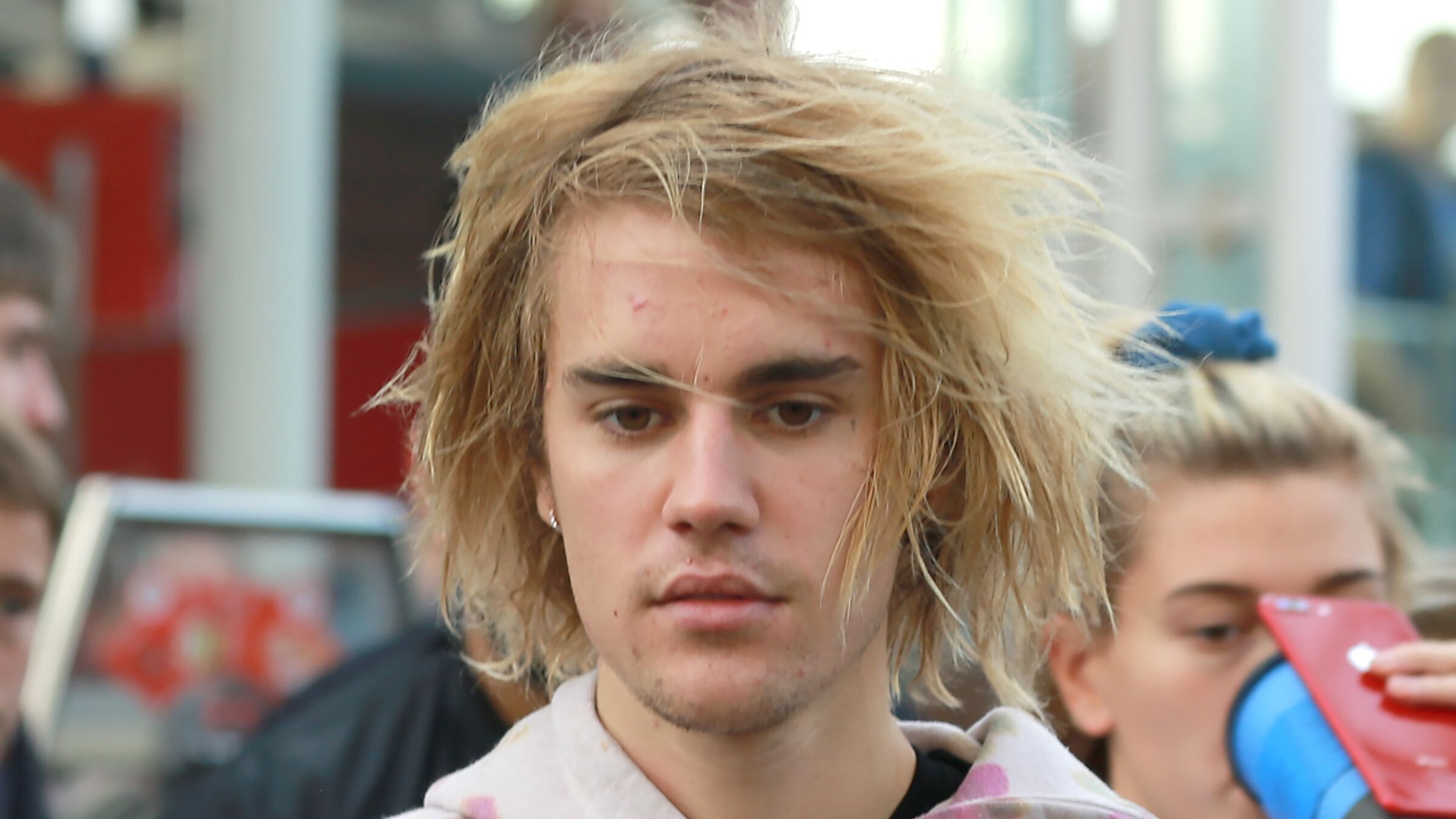 Justin Bieber Revele Etre Atteint De La Maladie De Lyme Voici