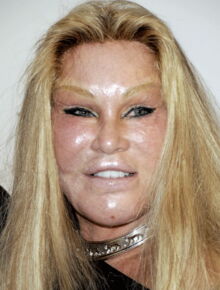 Jocelyn Wildenstein La Femme Chat Arretee Pour Avoir Sauvagement Griffe Son Petit Ami Voici