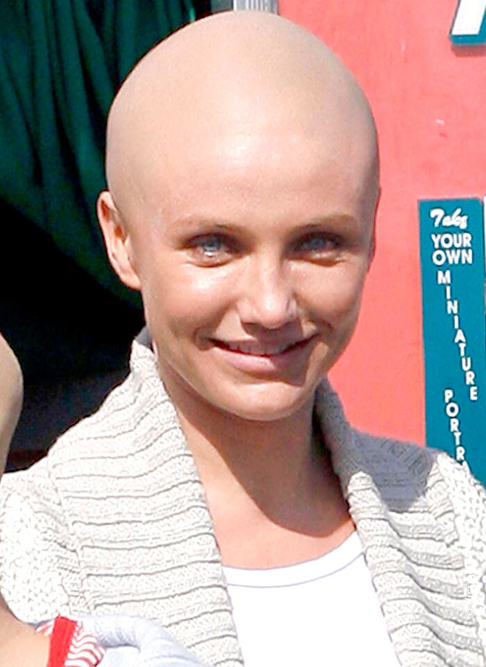 cheveux boule a zero