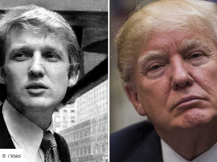 Donald Trump A 71 Ans Aujourd hui Son volution Physique En Une donald-trump-a-71-ans-aujourd-hui-son-volution-physique-en-une