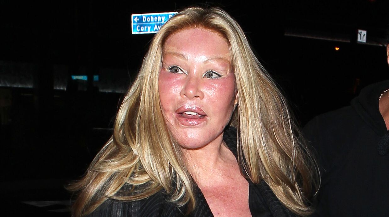 Jocelyn Wildenstein la femme  chat  est ruin e elle n a 