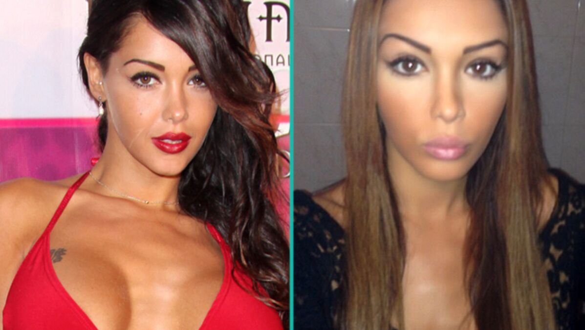 Kim K Retire Ses Implants PHOTO Nabilla aurait fait retirer ses implants mammaires - Voici