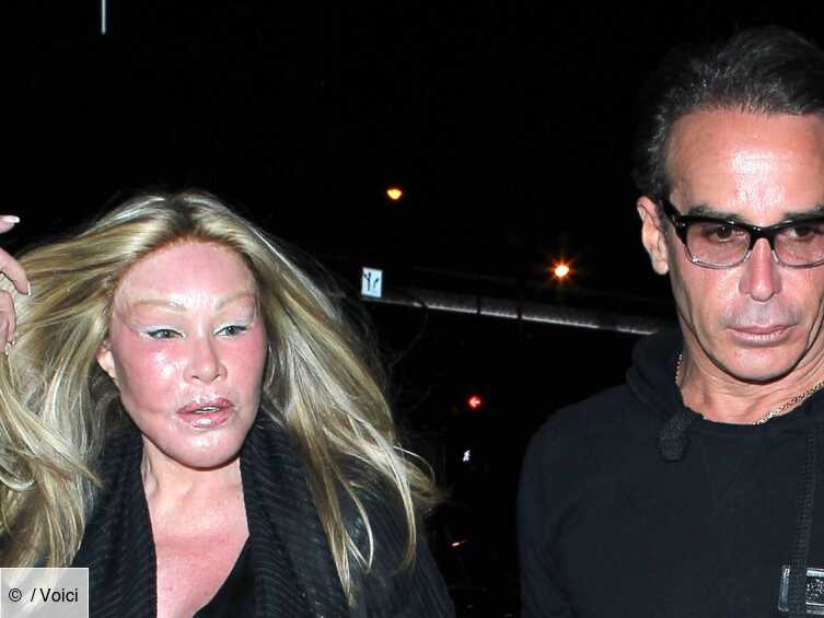 Jocelyn Wildenstein La Femme Chat Arretee Pour Avoir Sauvagement Griffe Son Petit Ami Voici