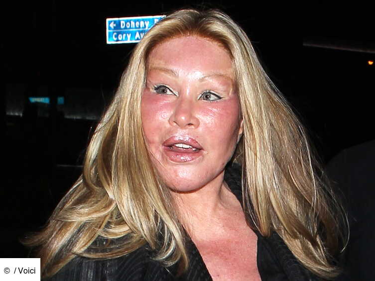 Jocelyn Wildenstein La Femme Chat Dit Avoir Ete Blessee Lors De La Dispute Avec Son Compagnon Voici