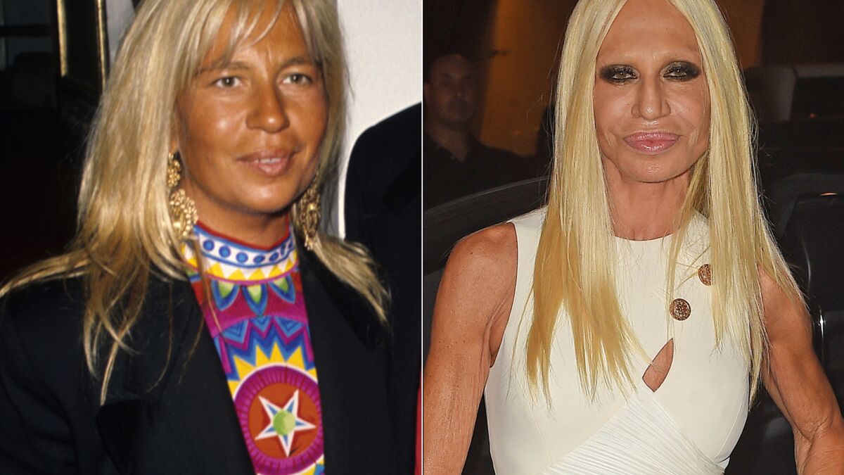Star Chirurgie Esthetique Ratee Avant Apres DIAPO Avant/après : les stars et la chirurgie esthétique, pour le meilleur  et pour le pire - Voici