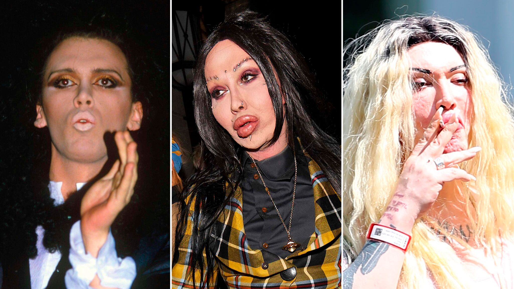 Photos Le Chanteur Pete Burns Defigure Par La Chirurgie Je Suis Frankenstein Voici