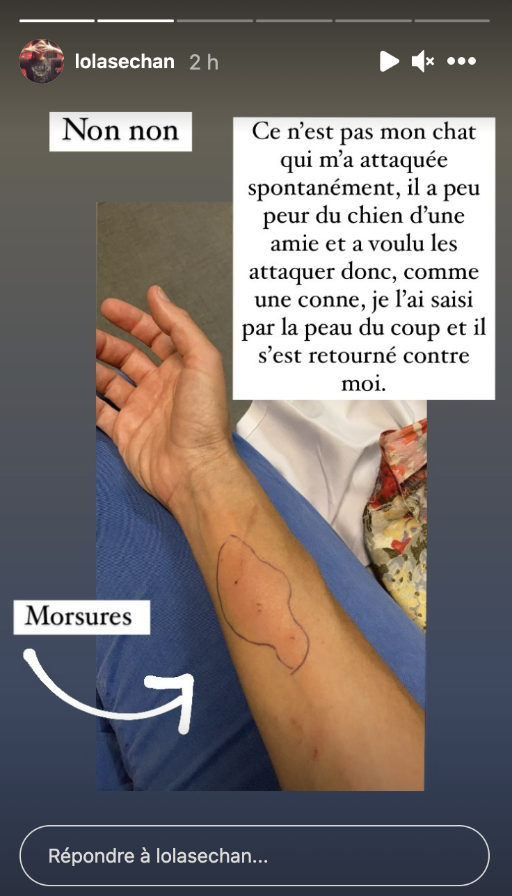Lola montrant sa mésaventure sur Instagram
