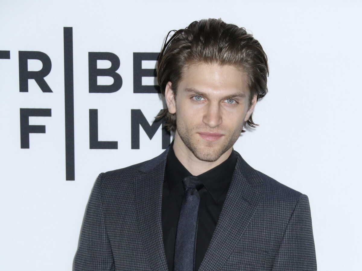 Keegan Allen (Pretty Little Liars) victime d'un vol à main armée : le visage ensanglanté, l'acteur raconte sa violente agression dans la rue