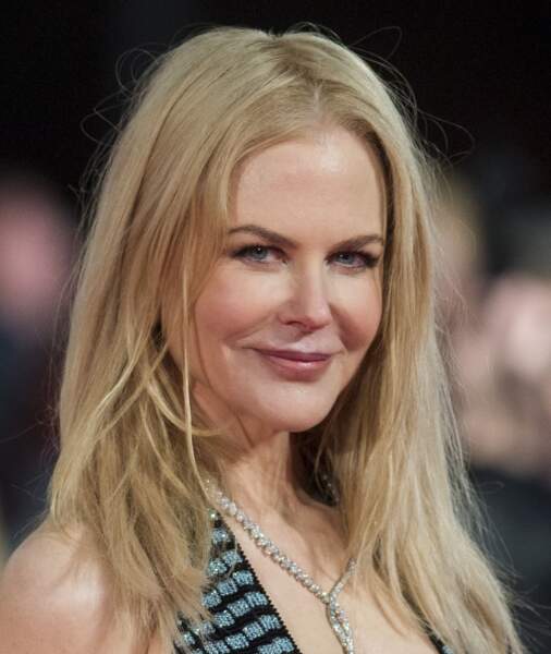 L'étrange visage de Nicole Kidman : Oui, vraiment, on se demande bien ce qui lui a pris
