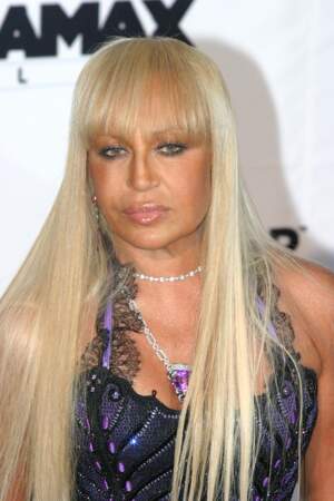 Ces stars qui ont VRAIMENT abusé de la chirurgie esthétique : Donatella Versace avant