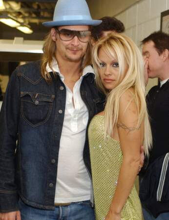 Kid Rock et Pamela Anderson ont été mariés pendant 4 mois