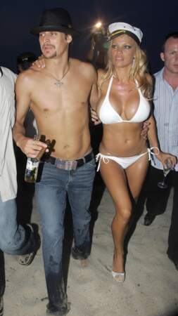 Robes de mariée de stars : Pamela Anderson et son bikini de mariage avec Kid Rock en 2006